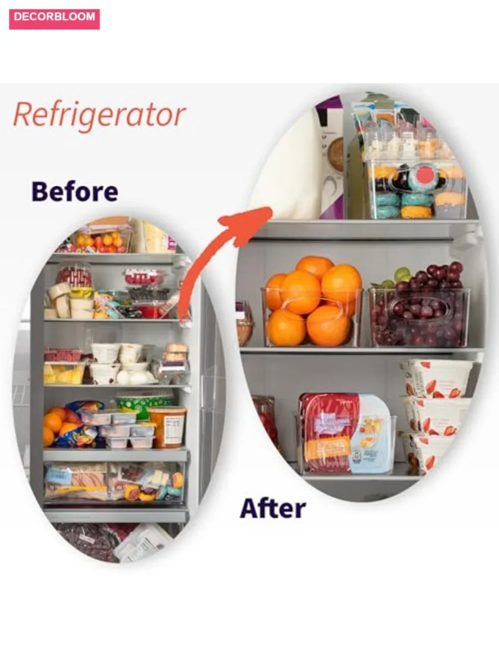 Clear Divided Pantry Fridge Organizer Bins with Removable Dividers